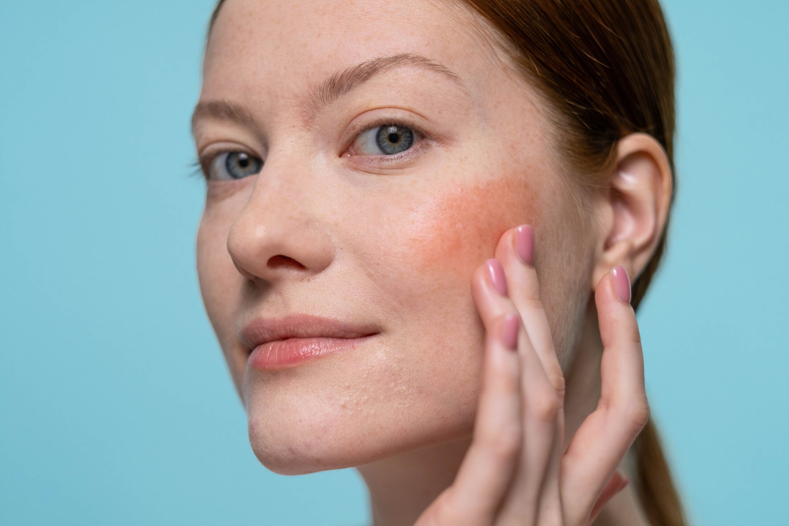 What Causes Skin Redness?