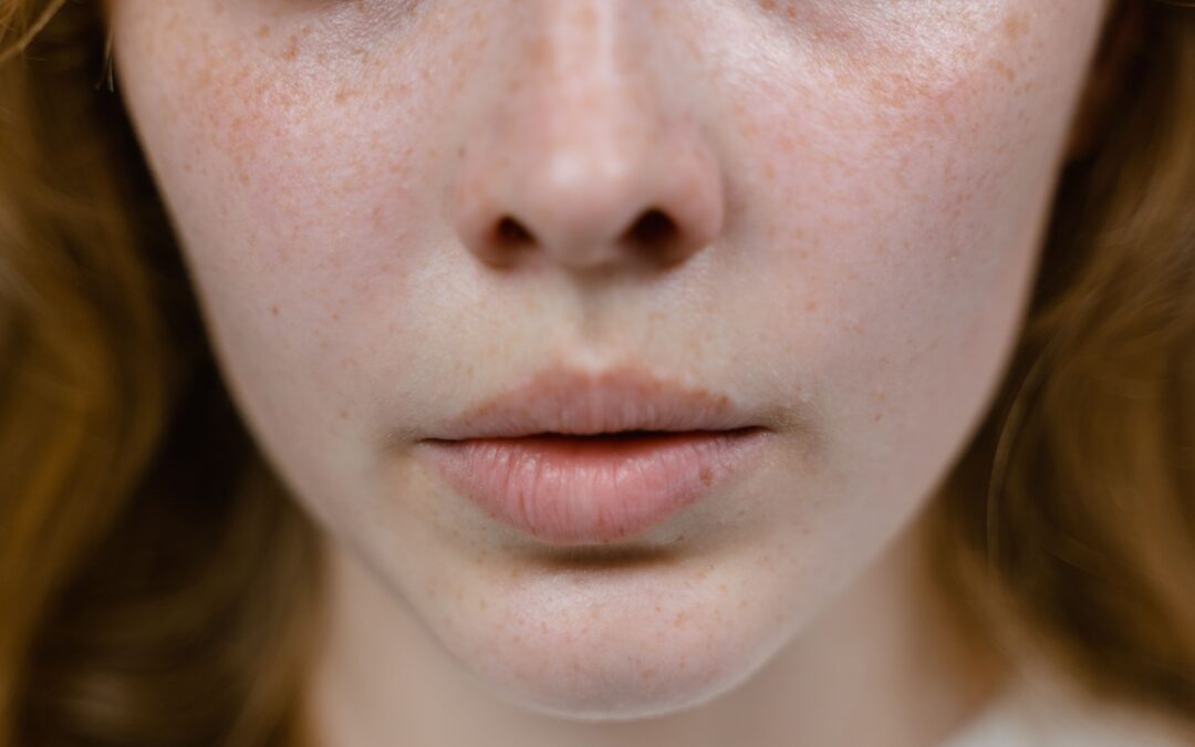What Causes Uneven Skin Texture?