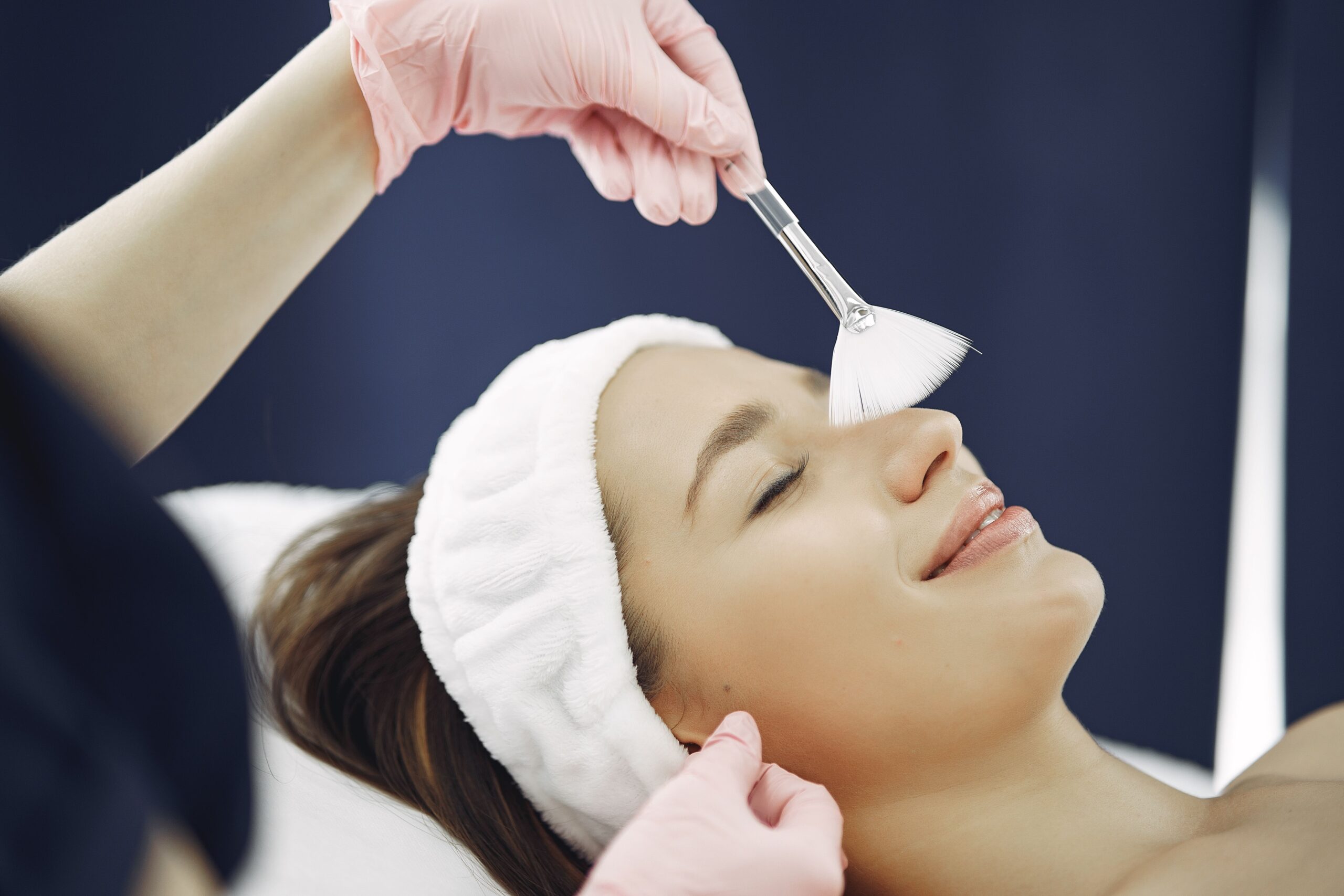 Chemical Peels